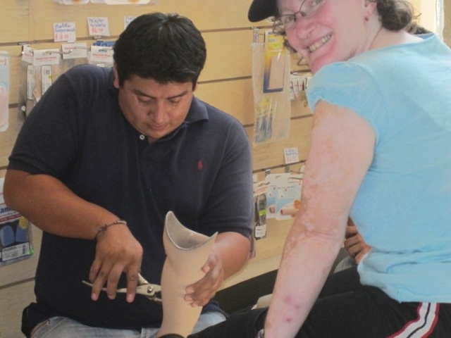 Rhonda with someone fixing her prosthetic leg